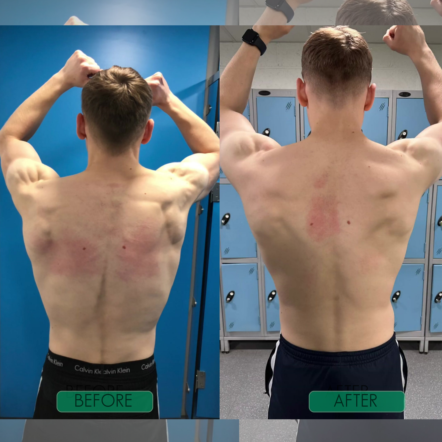 CoreCare® ─ Better Posture, Better Life